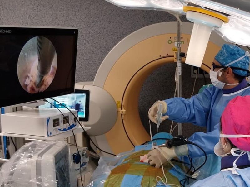 Endoscopia 1