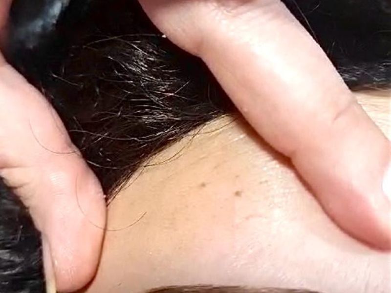 Cejas VCH 