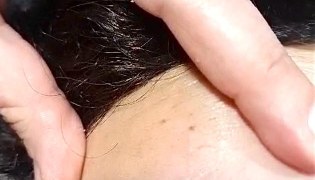 Cejas VCH 